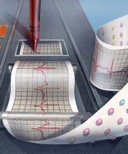 Editorial-Emergency-Medicine-Magazine-Pediatric-ECGs