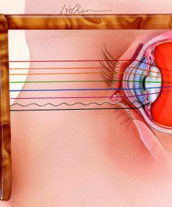 Pharm-RayBan